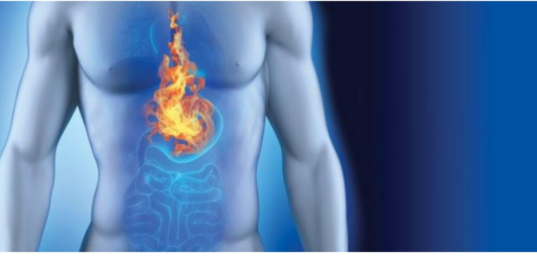 Acid Reflux And Exercise: Is It Helpful?